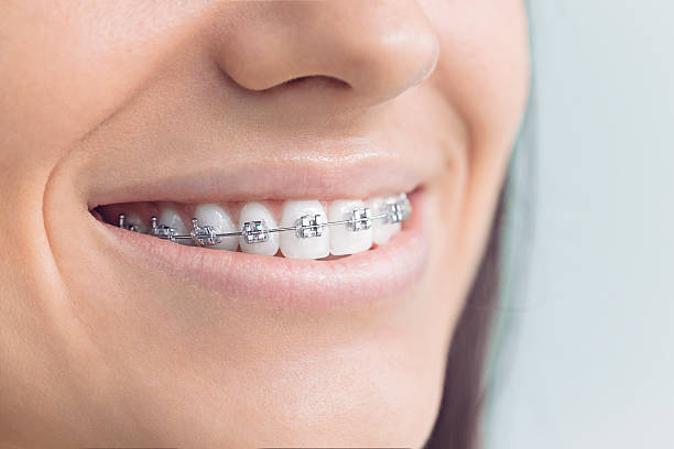 Best Sedation Dentistry  in Lake Leann, MI